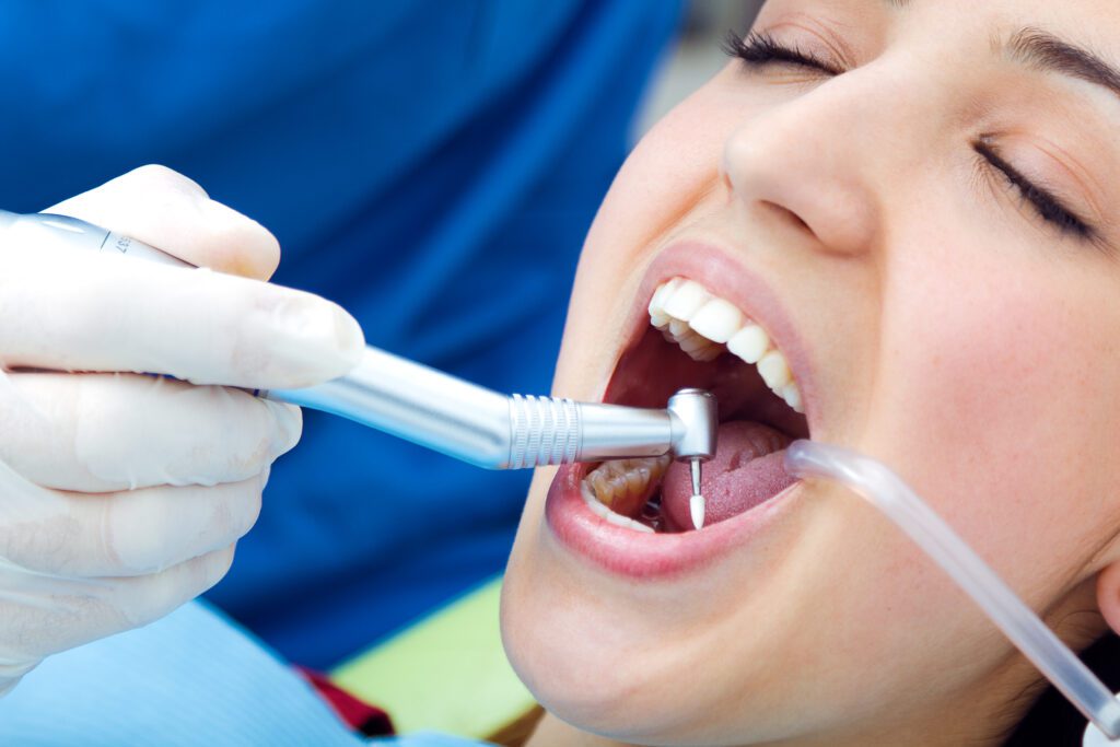 pulizia dei denti ogni quanto
