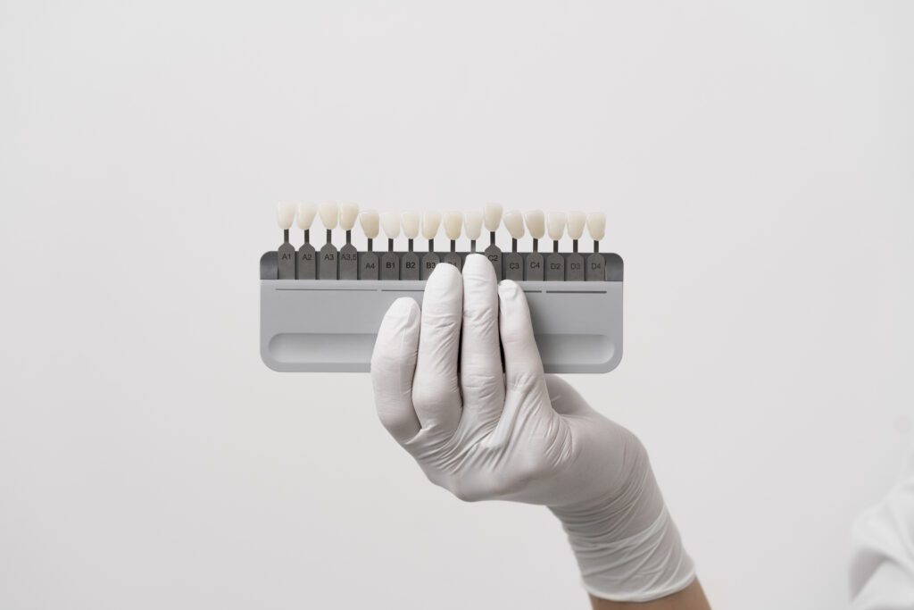 Faccette dentali