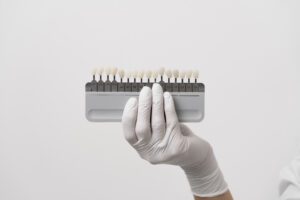 Faccette dentali
