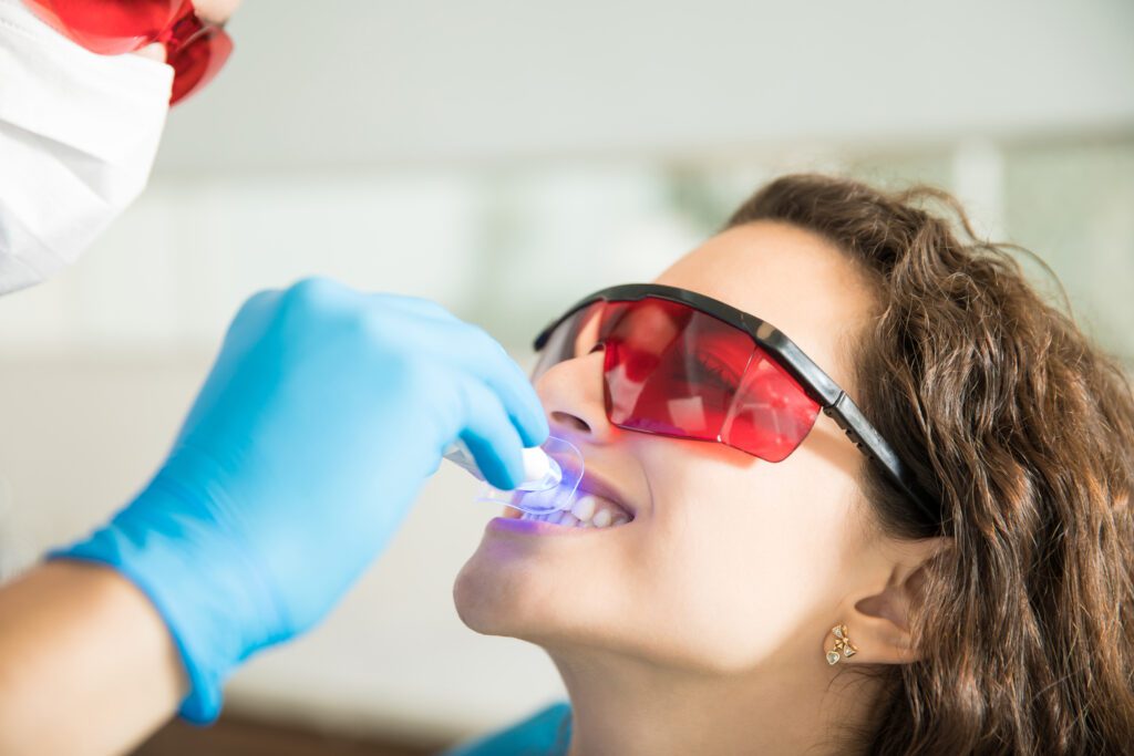 Quanto dura lo sbiancamento dentale