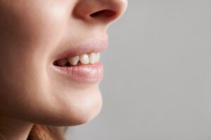 Denti storti in età adulta